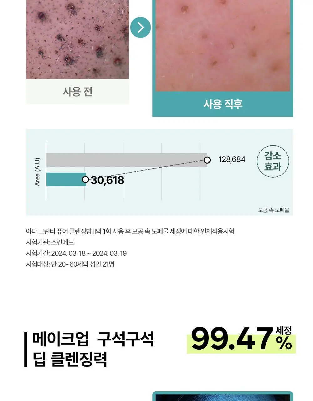 [블랙헤드제거] 야다 그린 티 퓨어 클렌징 밤 100ml 상세페이지 27